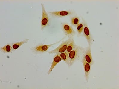 HIST1H1C Antibody