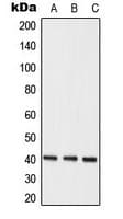 HNRNPC / HNRNP C Antibody (C-Terminus)