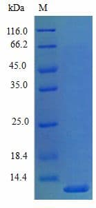 Mouse CXCL5 Protein (Recombinant)