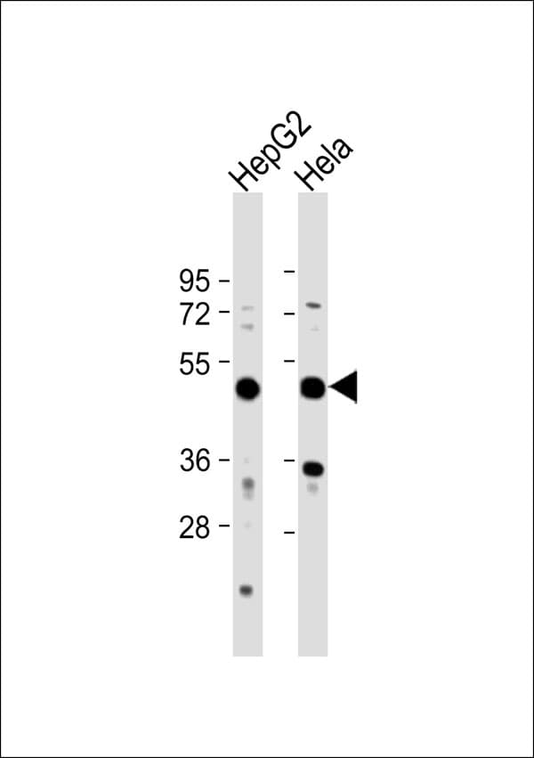 Polyclonal Rabbit anti-Human RSAD1 Antibody (WB)