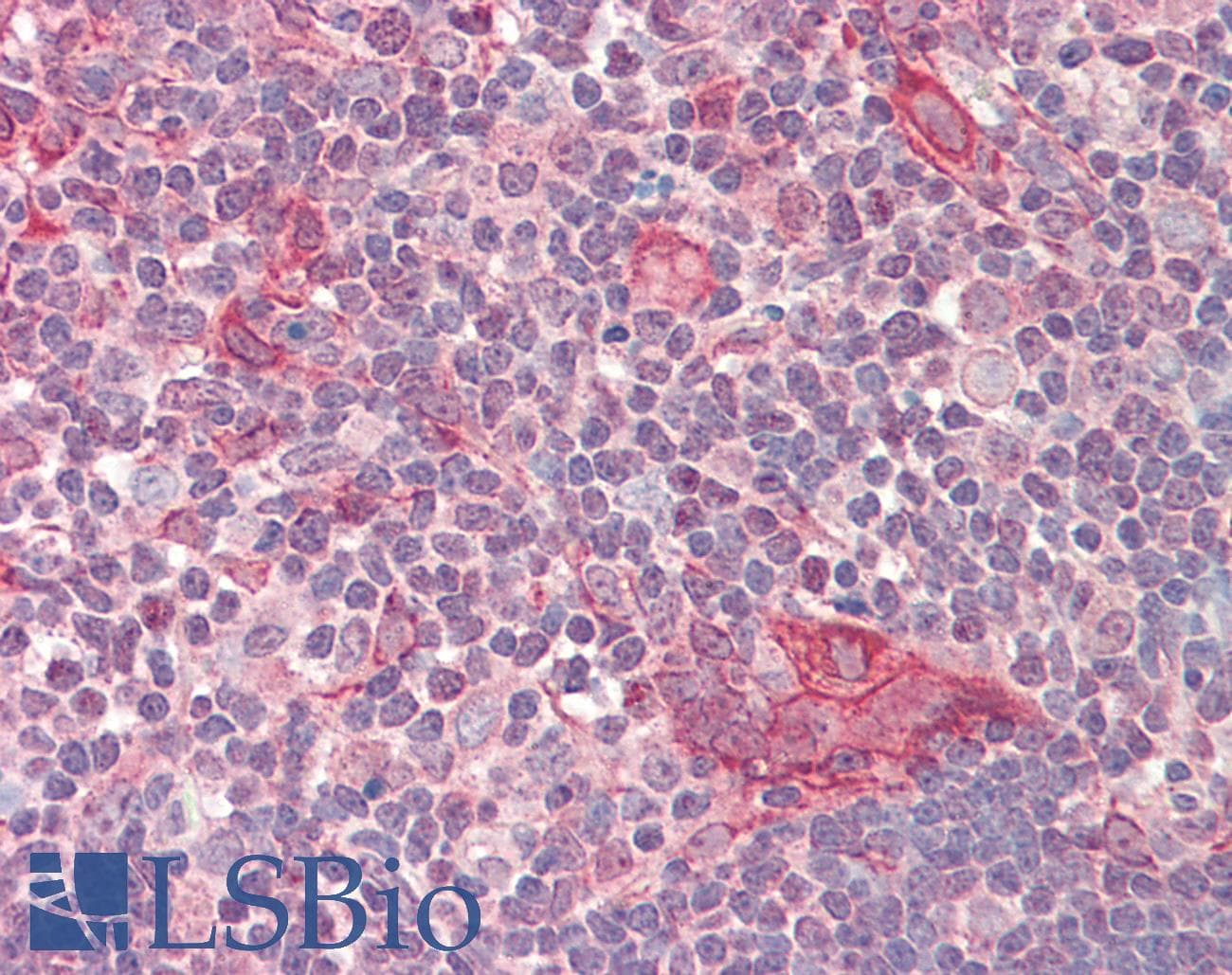 NUSAP1 / NUSAP Antibody (aa360-409)