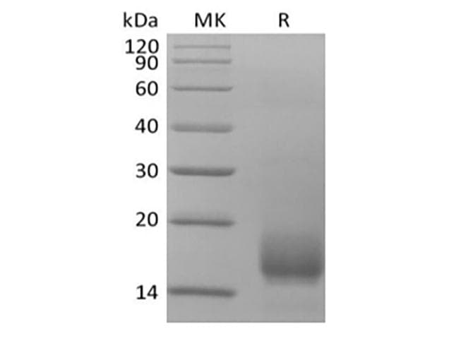 Human CD59 Protein (Recombinant 6His, C-terminus)