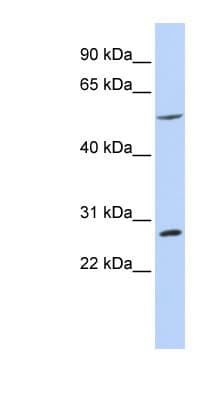 BTBD2 Antibody (aa108-157)