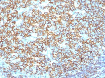 Recombinant Monoclonal Rabbit anti-Human CD20 Antibody (clone IGEL/1497R, Azide-free,Carrier-free, IHC)