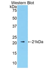 SHBG Antibody (aa219-358)