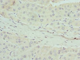 APOM / Apolipoprotein M Antibody