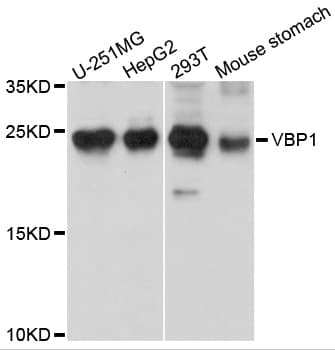 Polyclonal Rabbit anti-Human VBP1 Antibody (WB)