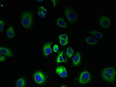Polyclonal Rabbit anti-Human SLC7A3 / CAT-3 Antibody