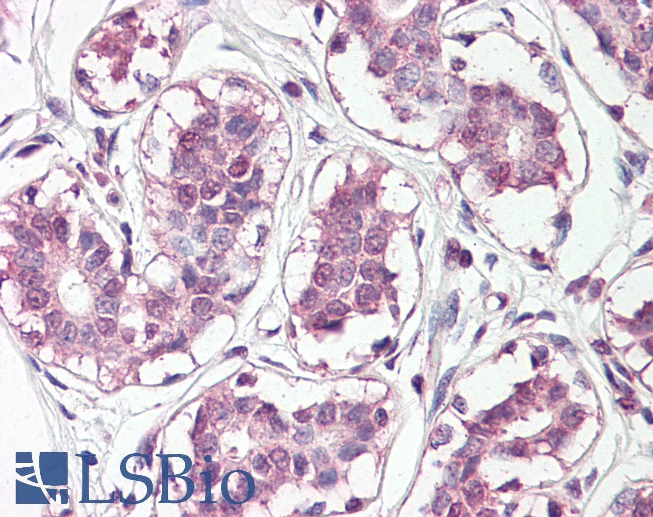 Polyclonal Rabbit anti-Human HOXC10 Antibody (N-Terminus, IHC, WB)