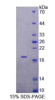 Mouse TBCA Protein (Recombinant His-T7)