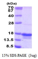 Human PTRHD1 / C2orf79 Protein (Recombinant His)