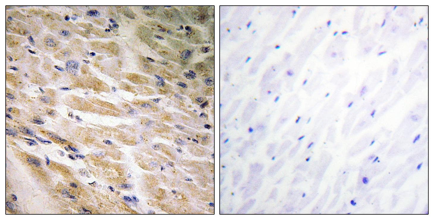 MEF2C Antibody (phospho-Ser387)