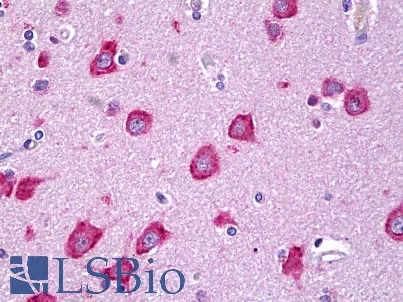 IHC-plus™ Monoclonal Mouse anti-Human MLKL Antibody (clone 3B2, IHC, WB)