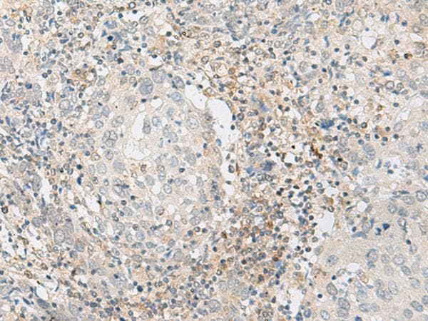 zinc finger and BTB domain containing 8 Antibody