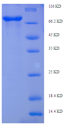 Human EIF2AK2 / PKR Protein (Recombinant His-SUMO)