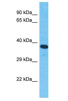 IOP1 / NARFL Antibody (aa291-340)