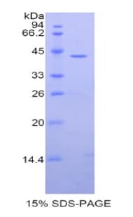 Human Carboxypeptidase O / CPO Protein (Recombinant His, N-Terminal)