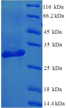 Human LGALS1 / Galectin 1 Protein (Recombinant His-SUMO)
