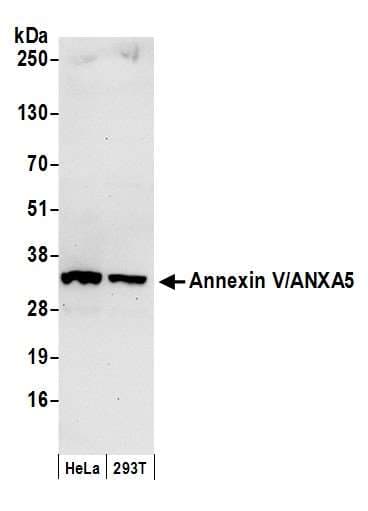 ANXA5 / Annexin V Antibody (aa1-50)