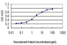 F12 / Factor XII Antibody (clone 3A3)