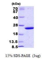 E. coli mug Protein (Recombinant His)