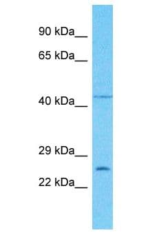PLSCR5 Antibody (aa142-191)