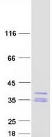 Human HAGH Protein (Recombinant Myc-DDK (Flag))