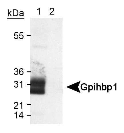 GPIHBP1 Antibody (Internal, DY488)