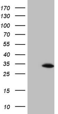 BCL2 / Bcl-2 Antibody (clone OTI1H1)
