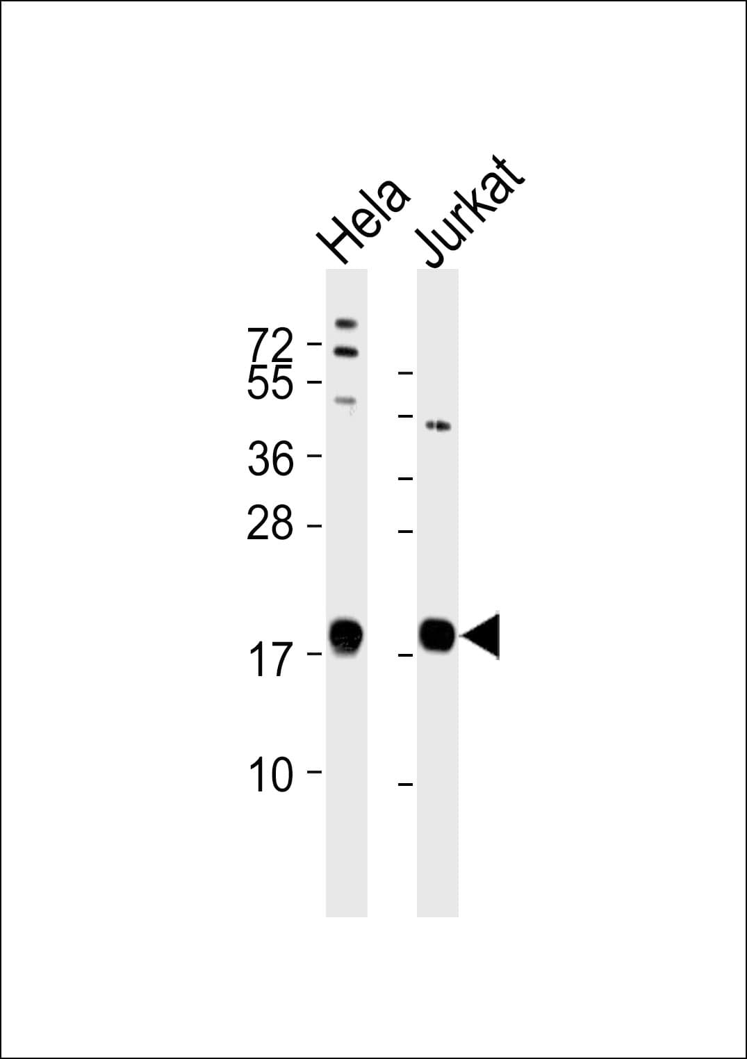 RPL35 / Ribosomal Protein L35 Antibody