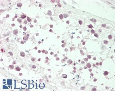 IHC-plus™ FBL / FIB / Fibrillarin Antibody (aa1-50)