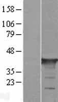 GAS7 Protein (Over-Expression Lysate Myc-DDK (Flag))