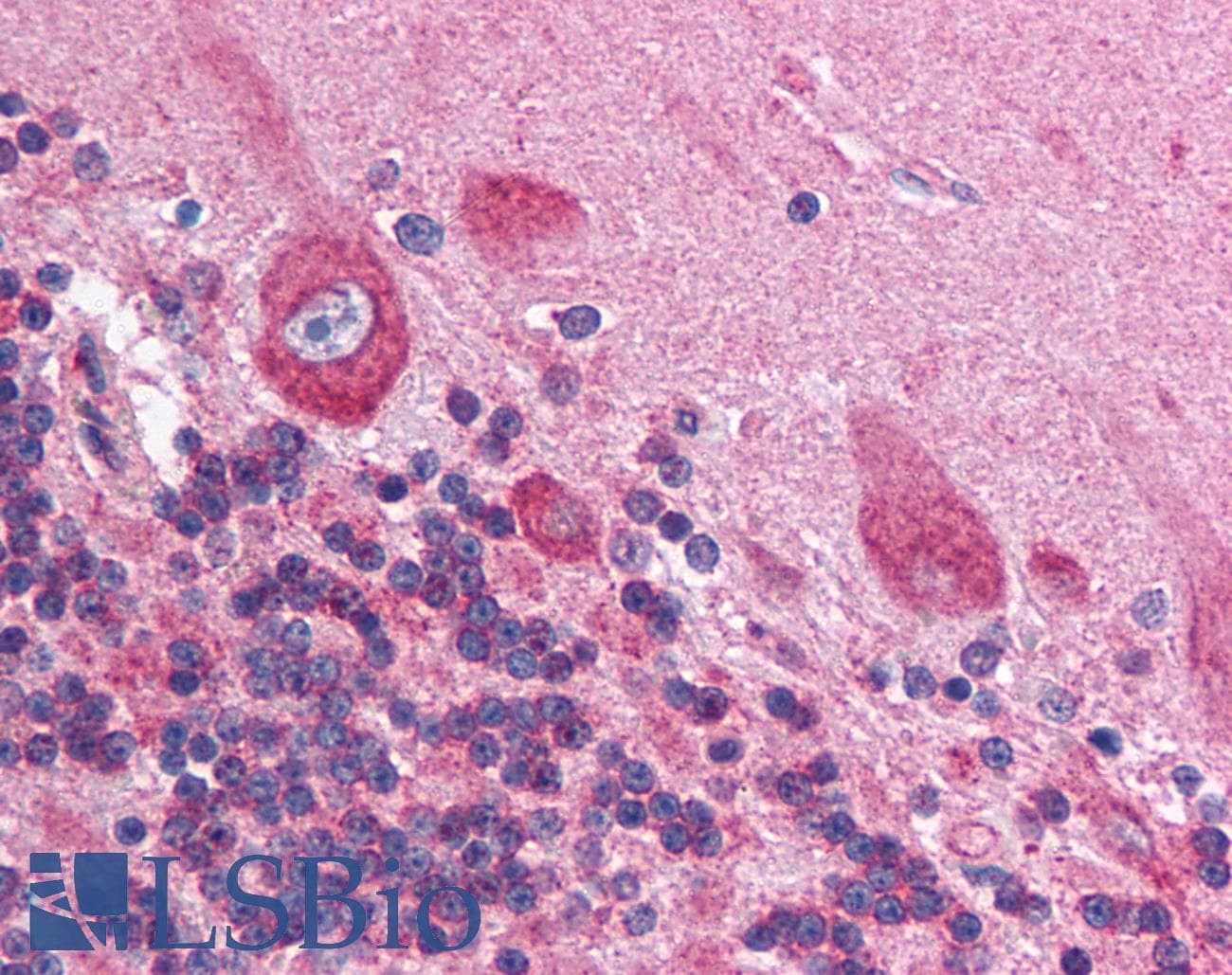 HIF1AN Antibody (N-Terminus)