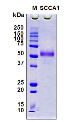 Human SERPINB3 Protein (Recombinant 6His, N-terminus)