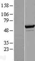 SARS / Serine-tRNA Ligase Protein (Over-Expression Lysate Myc-DDK (Flag))