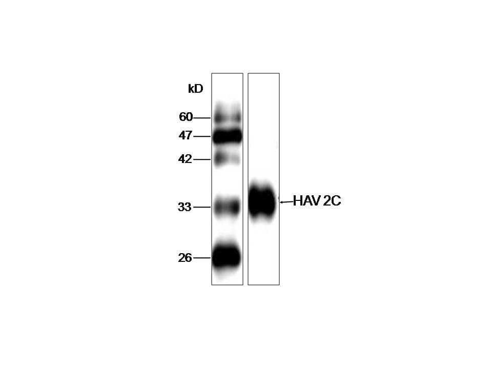 Monoclonal Mouse anti-Hepatitis A Virus HAV Polyprotein Antibody (clone BU-33, aa1141-1370, WB)