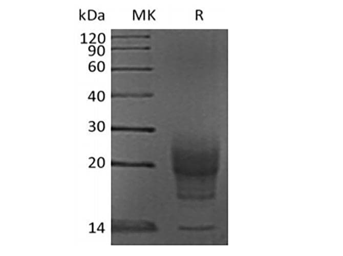 Mouse PRL / Prolactin Protein (Recombinant 6His, C-terminus)