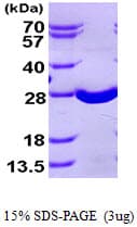 Human SOD2 / Mn SOD Protein (Recombinant His)