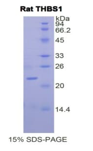 Rat THBS1 / Thrombospondin-1 Protein (Recombinant His)