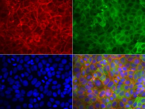 Monoclonal Mouse anti-Human KRT19 / CK19 / Cytokeratin 19 Antibody (clone UMAB188, Carrier-free, aa240-390, IHC, IF, WB)