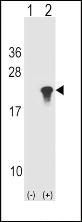 Polyclonal Rabbit anti-Human SNCA / Alpha-Synuclein Antibody (aa75-104, IHC, WB)
