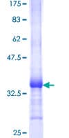 Human PSCA Protein (Recombinant GST, N-terminus)