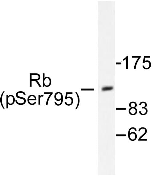 RB1 / Retinoblastoma / RB Antibody (phospho-Ser795)