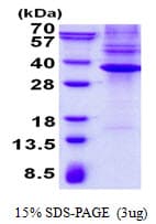 Human NKX3-1 Protein (Recombinant His)
