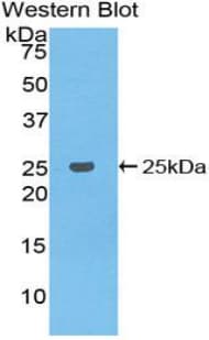 BCL2L1 / BCL-XL Antibody (aa2-212, Biotin)