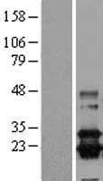 Prostaglandin D Synthase Protein (Over-Expression Lysate Myc-DDK (Flag))