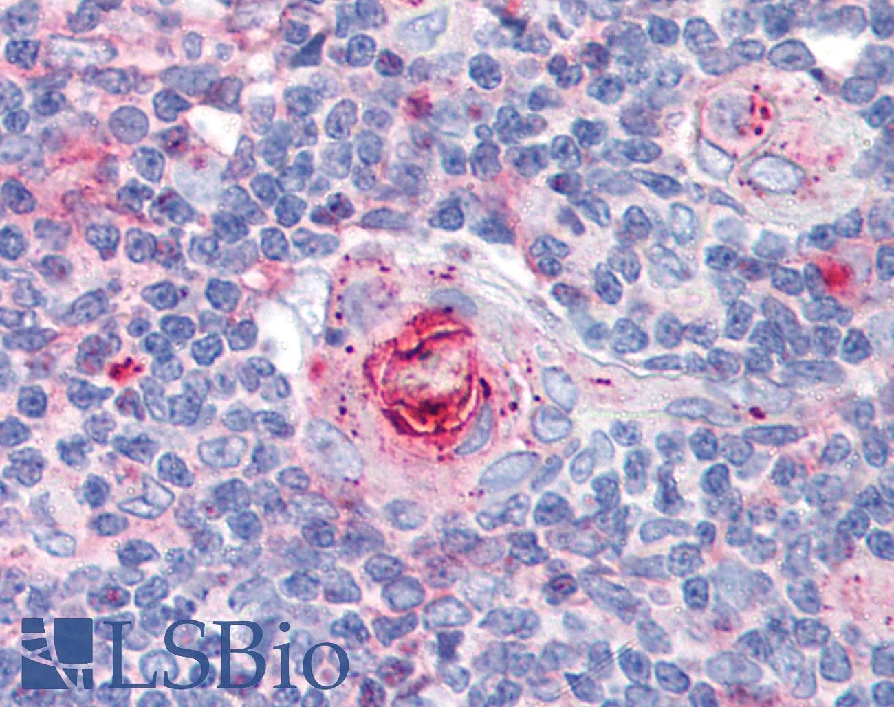 IHC-plus™ ICAM-1 / CD54 Antibody (clone MEM-111)