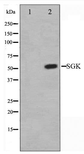 SGK1 / SGK Antibody