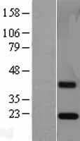 ESM1 / Endocan Protein (Over-Expression Lysate Myc-DDK (Flag))