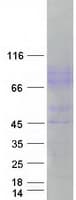 Human ICAM-1 / CD54 Protein (Recombinant Myc-DDK (Flag))